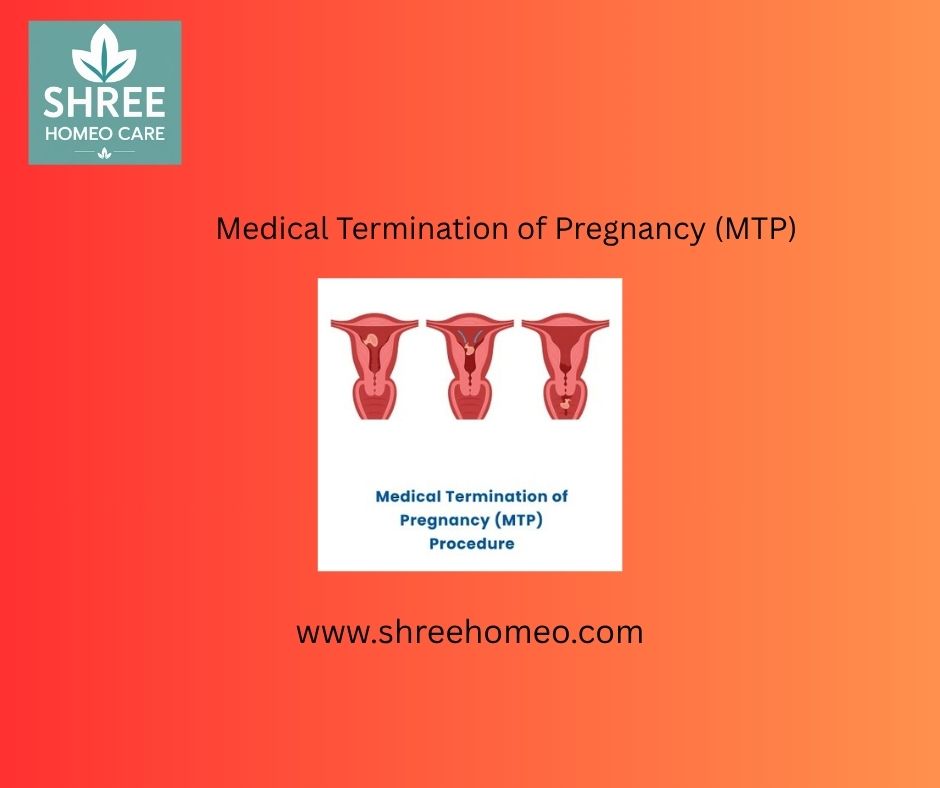 Medical Termination of Pregnancy (MTP)